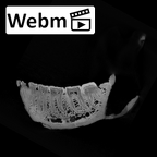 SK 23 Paranthropus robustus mandible ct stack movie