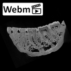 SK 23 Paranthropus robustus mandible dentition ct stack movie