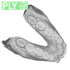 SK 23 Paranthropus robustus mandible dentition ply