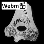 SK 24600 Paranthropus robustus left humerus ct stack movie