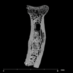 SK 24601 Paranthropus robustus left radius internal