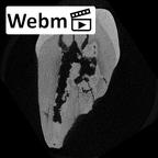 SK 24 Paranthropus robustus ULP3 ct stack movie