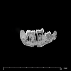 SK 25 Paranthropus robustus mandible internal
