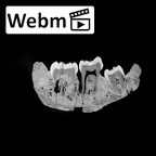 SK 25 Paranthropus robustus mandible ct stack movie