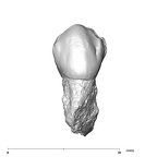 SK 27 Homo ULP3 buccal