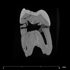 SK 31 Paranthropus robustus URM3 internal