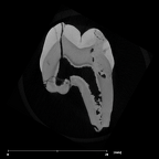 SK 33 Paranthropus robustus URP3 internal