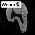 SK 33 Paranthropus robustus URP3 ct stack movie