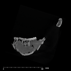 SK 34 Paranthropus robustus left hemimandible internal