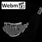 SK 34 Paranthropus robustus left hemimandible ct stack movie