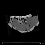 SK 34 Paranthropus robustus left hemimandible dentition internal