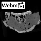 SK 34 Paranthropus robustus left hemimandible dentition ct stack movie