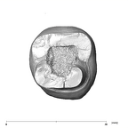 SK 3974 Paranthropus robustus LRM1 apical