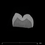 SK 3974 Paranthropus robustus LRM1 internal