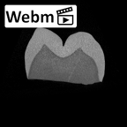 SK 3974 Paranthropus robustus LRM1 ct stack movie