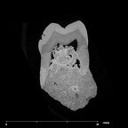 SK 3975 Paranthropus robustus ULM3 internal