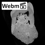 SK 3975 Paranthropus robustus ULM3 ct stack movie