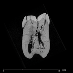 SK 3976 Paranthropus robustus LLM2 internal