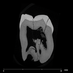 SK 3977 Paranthropus robustus URM3 internal