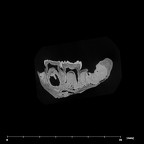 SK 3978 Paranthropus robustus mandible internal