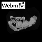 SK 3978 Paranthropus robustus mandible ct stack movie
