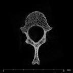 SK 3981a Paranthropus robustus T12 vertebra internal