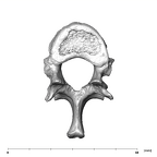 SK 3981a Paranthropus robustus T12 vertebra superior