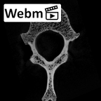SK 3981a Paranthropus robustus T12 vertebra ct stack movie
