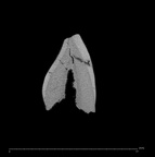 SK 40 Paranthropus robustus ULI1 internal