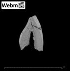 SK 40 Paranthropus robustus ULI1 ct stack movie