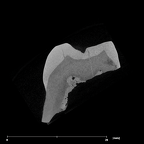 SK 41 Paranthropus robustus ULM3 internal