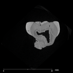 SK 44 Paranthropus robustus URP3 internal