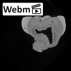 SK 44 Paranthropus robustus URP3 ct stack movie