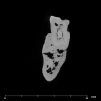 SK 45 Homo partial mandible dentition LRM2 internal
