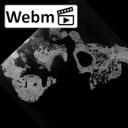 SK 46 Paranthropus robustus left temporal ct stack movie