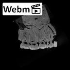 SK 48.SKW 7 Paranthropus robustus maxilla ct stack movie
