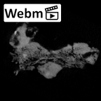 SK 49 Paranthropus robustus cranial fragment ct stack movie