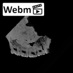 SK 49 Paranthropus robustus maxilla ct stack movie
