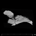 SK 54 Paranthropus robustus cranial fragment internal