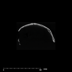 SK 54 Paranthropus robustus cranium internal