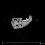 SK 62 Paranthropus robustus mandible internal