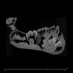 SK 63 Paranthropus robustus hemimandible left dentition internal