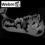 SK 63 Paranthropus robustus hemimandible left dentition ct stack movie