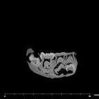 SK 63 Paranthropus robustus hemimandible right internal