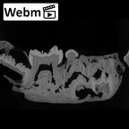 SK 63 Paranthropus robustus hemimandible right dentition ct stack movie