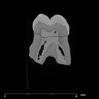 SK 6 Paranthropus robustus LRM2 internal