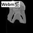 SK 6 Paranthropus robustus LRM2 ct stack movie