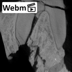 SK 6 Paranthropus robustus partial right hemimandible dentition ct stack movie
