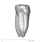SK 72 Paranthropus robustus LLP3 mesial