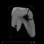 SK 74c Paranthropus robustus URP4 internal